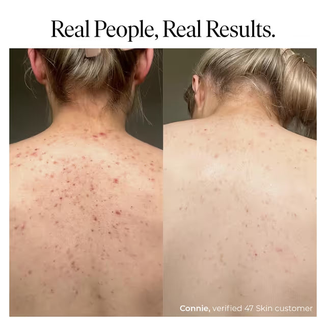 47 Skin anti-blemish moisteriser - Silver chitoderm - 150ml